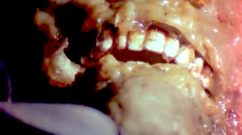 THE TEXAS CHAINSAW MASSACRE, R: Tobe Hooper USA 1974